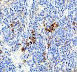 Neutrophil elastase Antibody in Immunohistochemistry (Paraffin) (IHC (P))