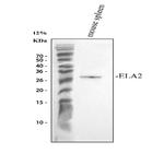 Neutrophil elastase Antibody in Western Blot (WB)