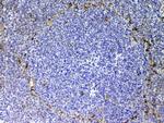 CD105 (Endoglin) Antibody in Immunohistochemistry (Paraffin) (IHC (P))