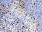 CD105 (Endoglin) Polyclonal Antibody