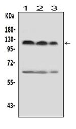 HIF-2 alpha Antibody in Western Blot (WB)