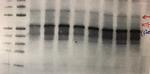 HIF-2 alpha Antibody in Western Blot (WB)