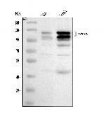 EPB41L1 Polyclonal Antibody