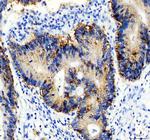EpCAM (CD326) Antibody in Immunohistochemistry (Paraffin) (IHC (P))
