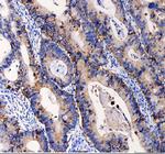 EpCAM (CD326) Antibody in Immunohistochemistry (Paraffin) (IHC (P))