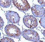 Epigen Antibody in Immunohistochemistry (Paraffin) (IHC (P))