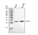 Epigen Antibody in Western Blot (WB)