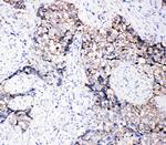 EphB3 Polyclonal Antibody