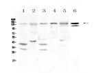 EPS15 Polyclonal Antibody