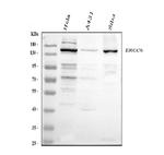 CSB Polyclonal Antibody