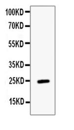 Endocan Polyclonal Antibody