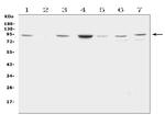 Factor VIII Polyclonal Antibody
