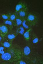 FABP2 Polyclonal Antibody