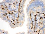FABP4 Polyclonal Antibody
