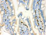 FABP4 Antibody in Immunohistochemistry (Paraffin) (IHC (P))