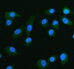 FABP5 Polyclonal Antibody