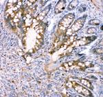 FABP5 Antibody in Immunohistochemistry (Paraffin) (IHC (P))