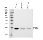 FABP5 Antibody in Western Blot (WB)