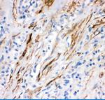 FAS (CD95) Antibody in Immunohistochemistry (Paraffin) (IHC (P))