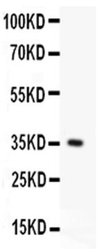FAS (CD95) Antibody in Western Blot (WB)