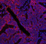 FASN Antibody in Immunohistochemistry (Paraffin) (IHC (P))