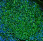 CD23 Antibody in Immunohistochemistry (Paraffin) (IHC (P))