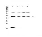 CD64 Polyclonal Antibody