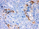 FCGRT Polyclonal Antibody