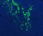 FDCSP Polyclonal Antibody