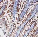 FER Polyclonal Antibody