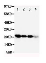 FGF1 Antibody in Western Blot (WB)