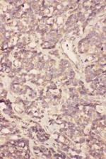 FGF19 Antibody in Immunohistochemistry (Paraffin) (IHC (P))