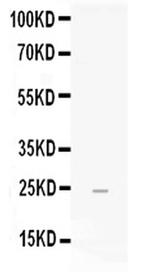 FGF19 Polyclonal Antibody