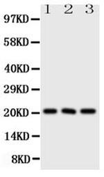 FGF21 Polyclonal Antibody