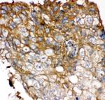 FGFR4 Polyclonal Antibody