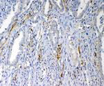VEGFD Polyclonal Antibody