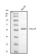 FMO5 Polyclonal Antibody