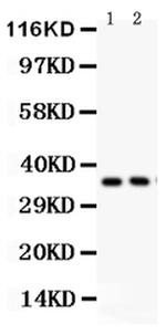 FRZB Polyclonal Antibody