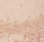FSH beta Antibody in Immunohistochemistry (Paraffin) (IHC (P))
