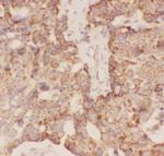 FSH beta Polyclonal Antibody