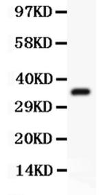 FSH beta Antibody in Western Blot (WB)