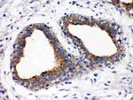 FUT1 Polyclonal Antibody