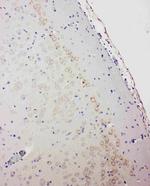 GABRA1 Polyclonal Antibody
