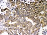 GAD65 Polyclonal Antibody
