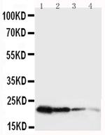 Growth Hormone Polyclonal Antibody