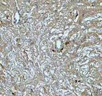 Growth Hormone Polyclonal Antibody