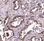 GLO1 Antibody in Immunohistochemistry (Paraffin) (IHC (P))