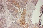 GRB7 Polyclonal Antibody
