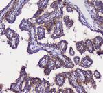 GRIK1 Polyclonal Antibody