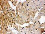 GRK5 Polyclonal Antibody